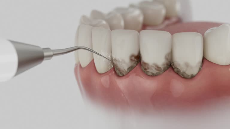 Reliable Dental Crowns And Bridges contractor in Saline County County, AR by Dentist Open Now